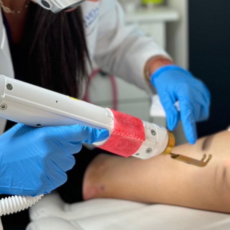 Aerolase Neo Elite Laser